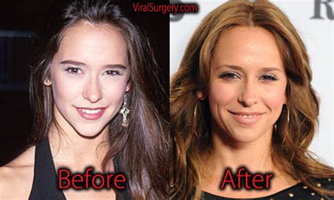 has jennifer love hewitt had plastic surgery|Jennifer Love Hewitt: Before and After